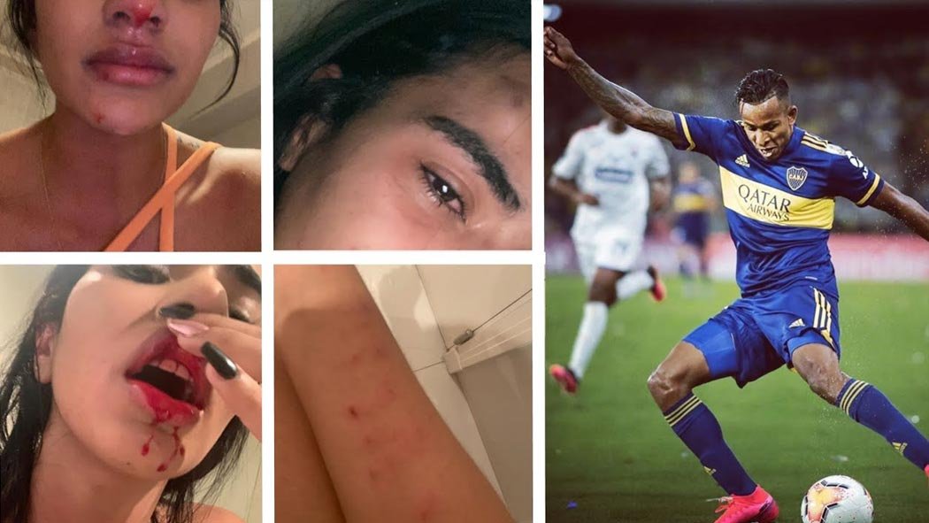 Daniela Cortes, pareja del jugador de Boca Juniors, Sebastián Villa, este lunes publicó en su cuenta de Instagram una extensa carta en la cual denuncia al futbolista de golpearla y publicó varias imágenes que así lo demostrarían.